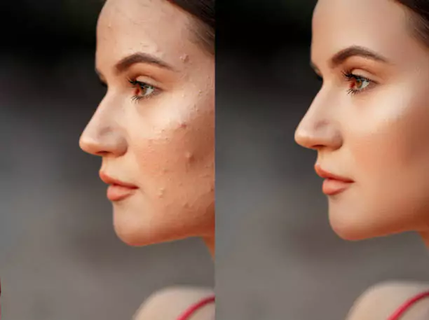 high-end-retouching-before-and-after