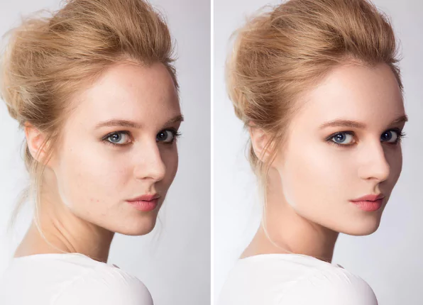 wrinkle-and-fine-line-reduction