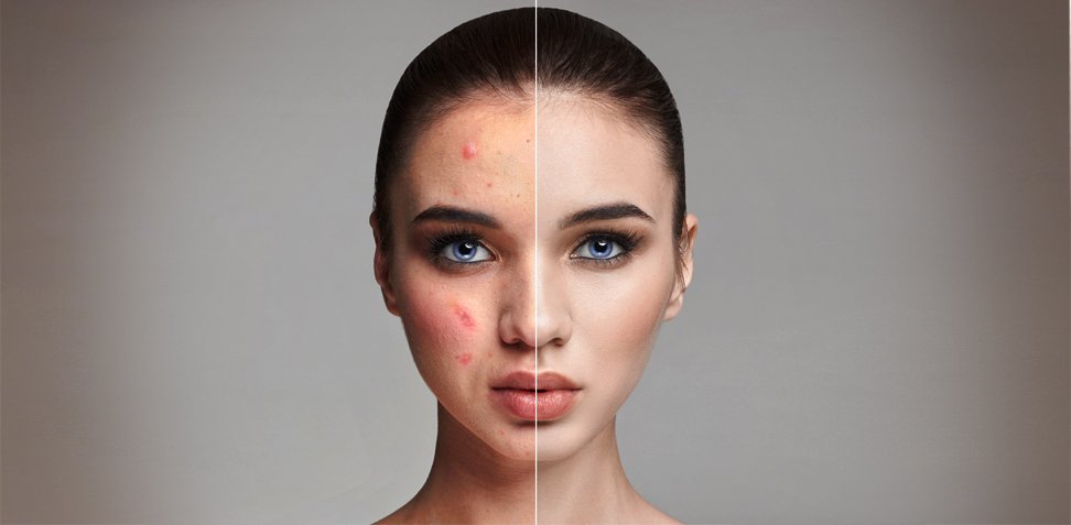 Photo retouching service