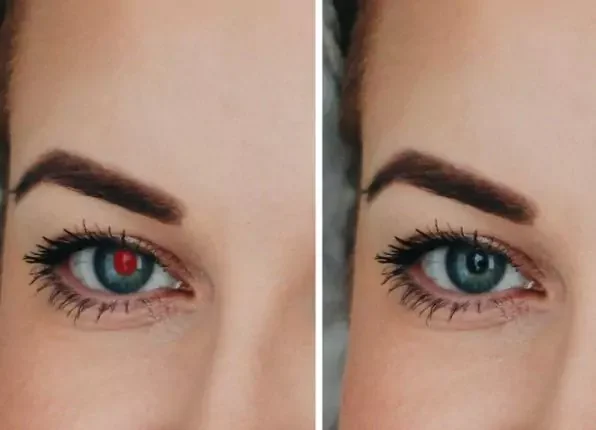 eye-brightening-and-red-eye-correction